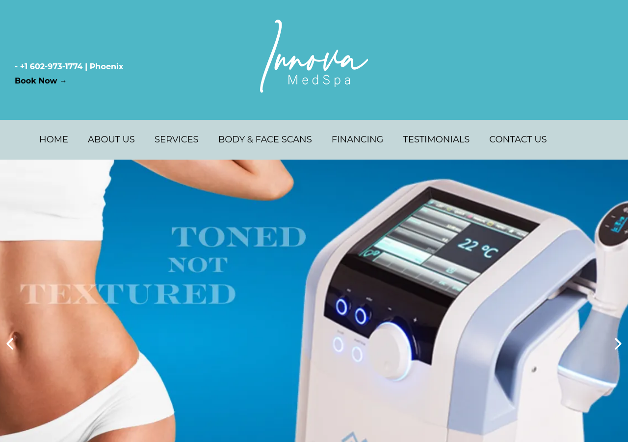 Screenshot of Top Med Spa in Phoenix, AZ | Virtue RF, CoolPeel, Fillers & More - Innova MedSpa